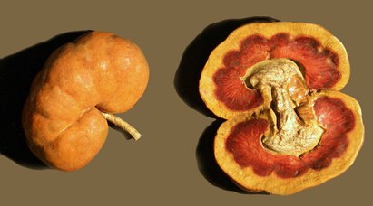 Dog (Canis familiaris L.). Nephrosis