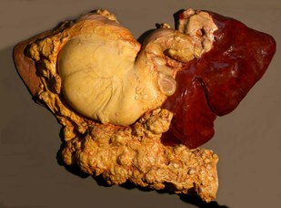 Horse (Equus caballus L.). Peritoneum's cancer