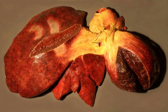 Liver of a horse (Equus caballus L.). Laceration