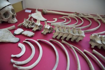 Complete skeleton of an adolescent