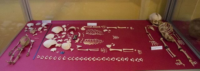Fetuses at different pregnancy stages