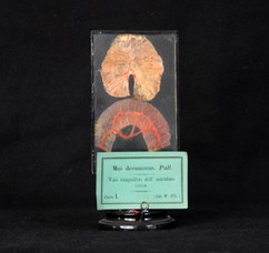 Intestine blood vessels of a rat (mus decumanus)