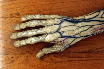 Detail of an anatomical model representing a hand and a forearm - Wax modeller: Clemente Susini