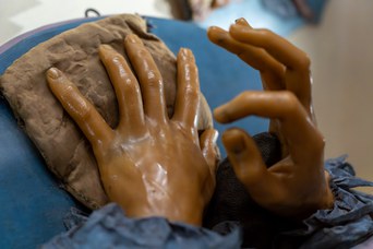 “Wax preparation depicting two hands,” Anna Morandi, 1755–74