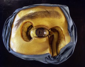 Modello anatomico rappresentante l'occhio e l'apparato lacrimale - Ceroplasta Cesare Bettini