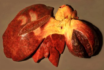 Equus caballus L. Fegato. Lacerazione