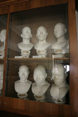 Calchi facciali in gesso di diversa origine etnica