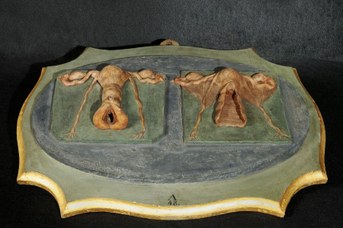 "Preparato in cera raffigurante vagina e utero non gravido e vagina e utero gravido", Giovanni Manzolini, 1746-50