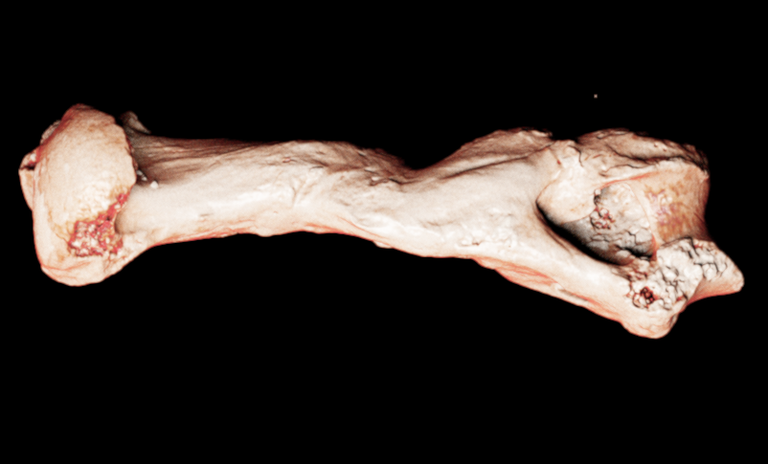 TAC di omero patologico di leone delle caverne della Collezione di Geologia "Museo Giovanni Capellini" TAC di omero patologico di leone delle caverne della Collezione di Geologia "Museo Giovanni Capellini"